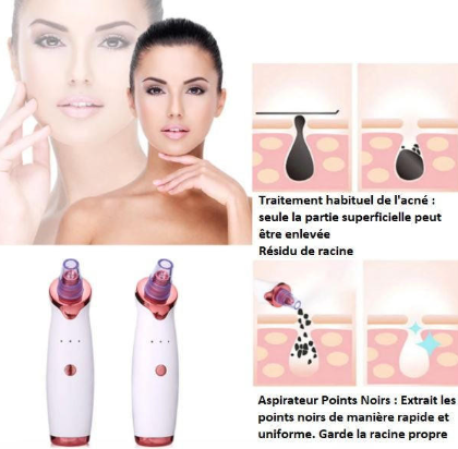 VEEMUNA-Aspirateur Points Noirs – Nettoyeur Pores FaceCare VEEMUNA